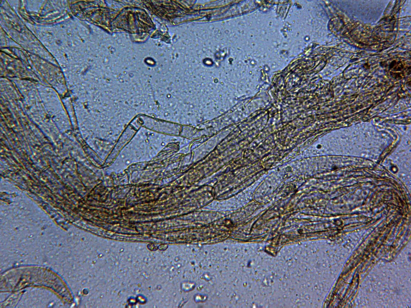 Microscopía de Inocybe langei - 10 - Escamas suprapellis agua x 400